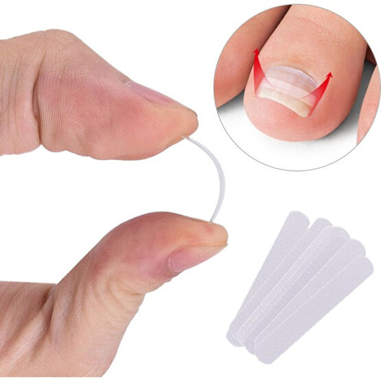 Shuai Yan Paron Batık Ayak Tırnağı Pedikür Aracı 10 Adet/Şişe Doğrultma Klip Kavisli Bs Brace Ayak Tırnaklarını Kalın Paronişi Düzeltme Aracı Ayak ... Manikür / Pedikür Malzemeleri ve Setleri Fiyatı
