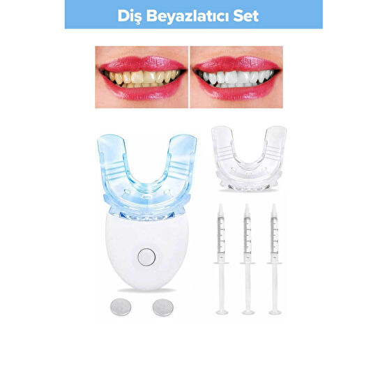 smileshop Diş Beyazlatma Seti Diş Beyazlatıcılar Fiyatı
